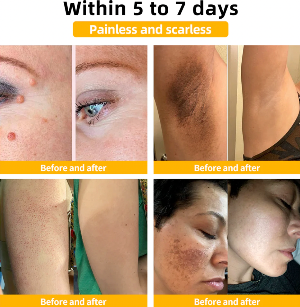 Bee Venom Skin Care Cream